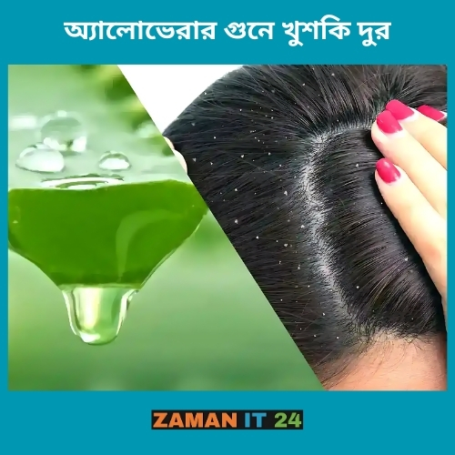 খুশকি দূর