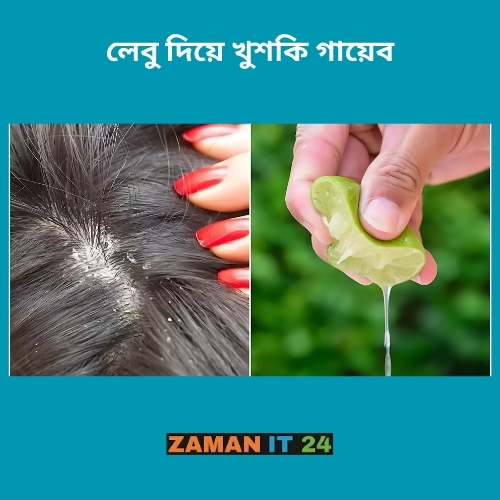 খুশকি দূর