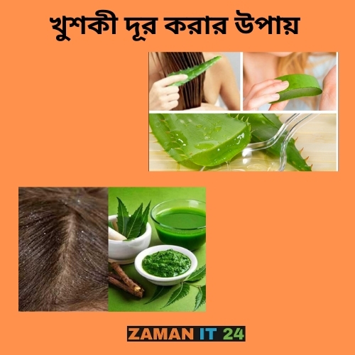 খুশকি দূর করার উপায়