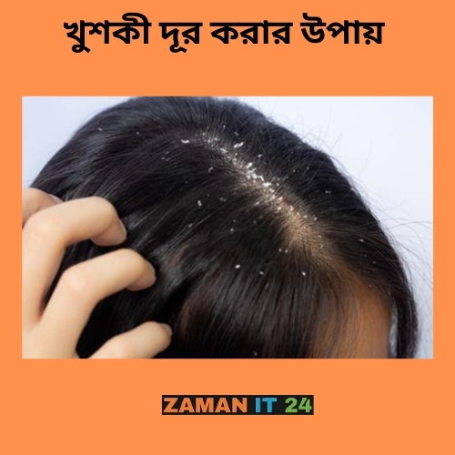 খুশকি দূর করার উপায়