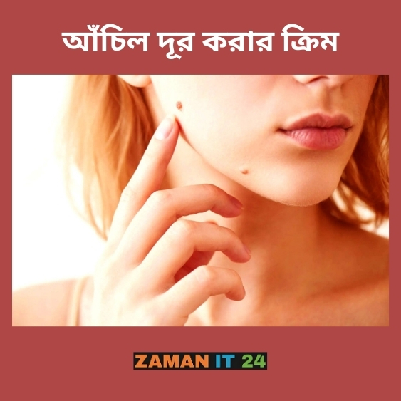 আঁচিল দূর করার ক্রিম